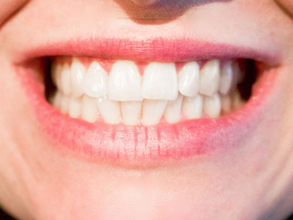 Parker-Dental-Group-Dentures
