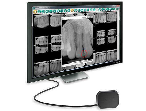 Parker-Dental-Group-Family-Dentists-X-Rays