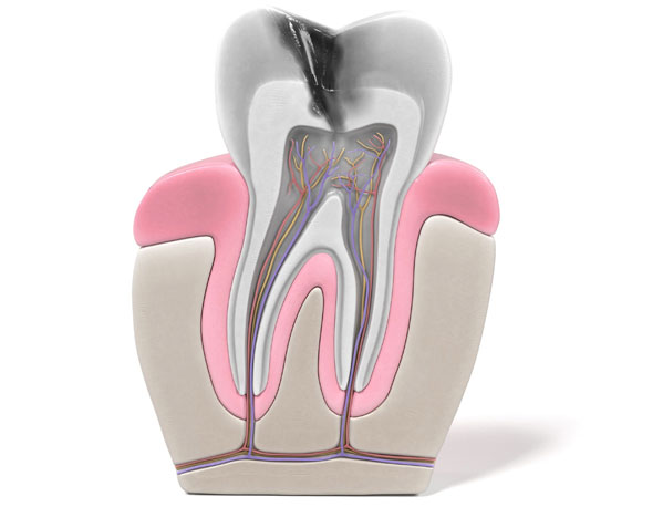 Parker-Family-Dental-Dental-Root-Canal-Therapy